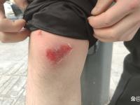 FB体育在线-速度赛场上意外发生，选手意外受伤