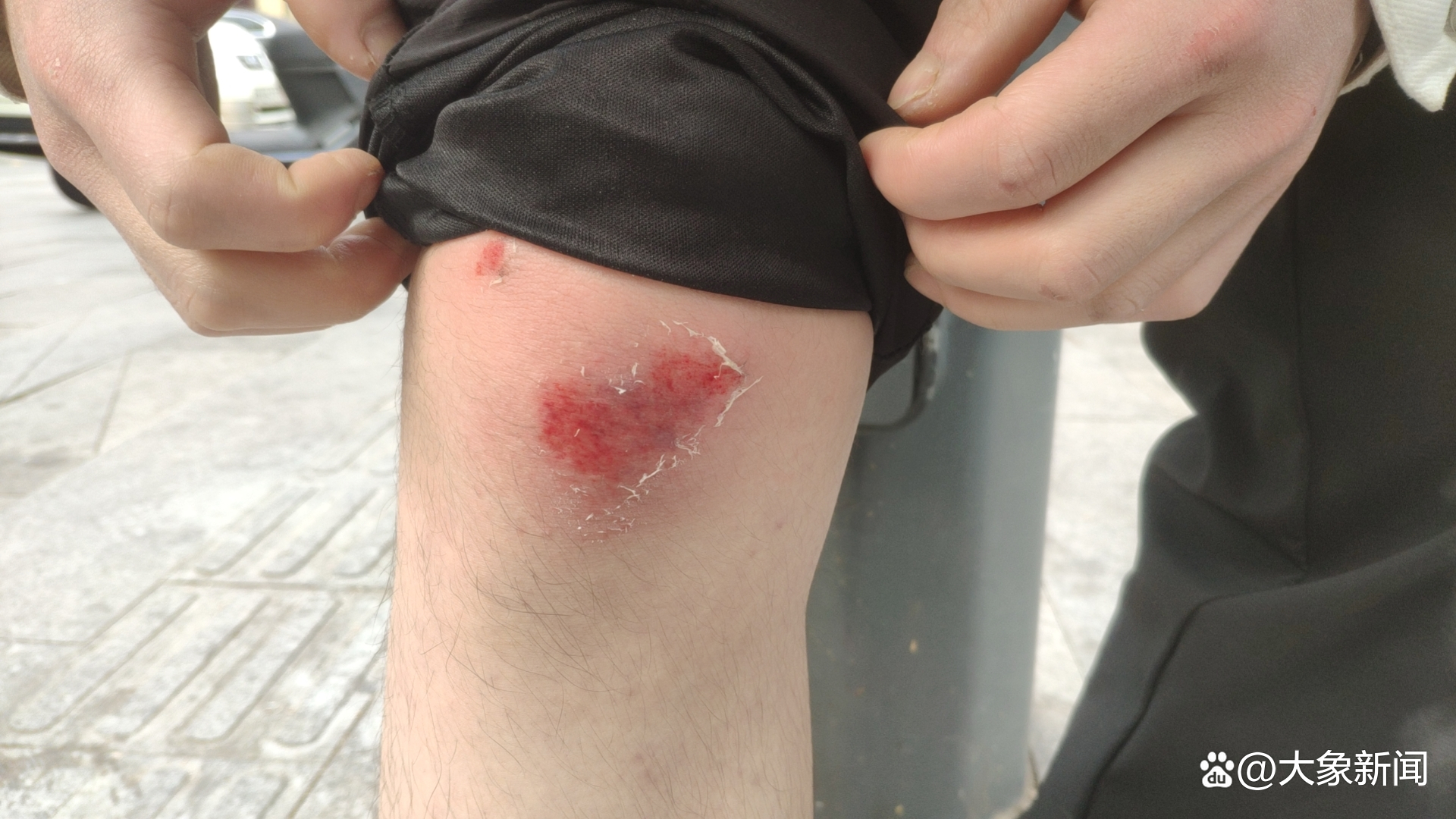 速度赛场上意外发生，选手意外受伤